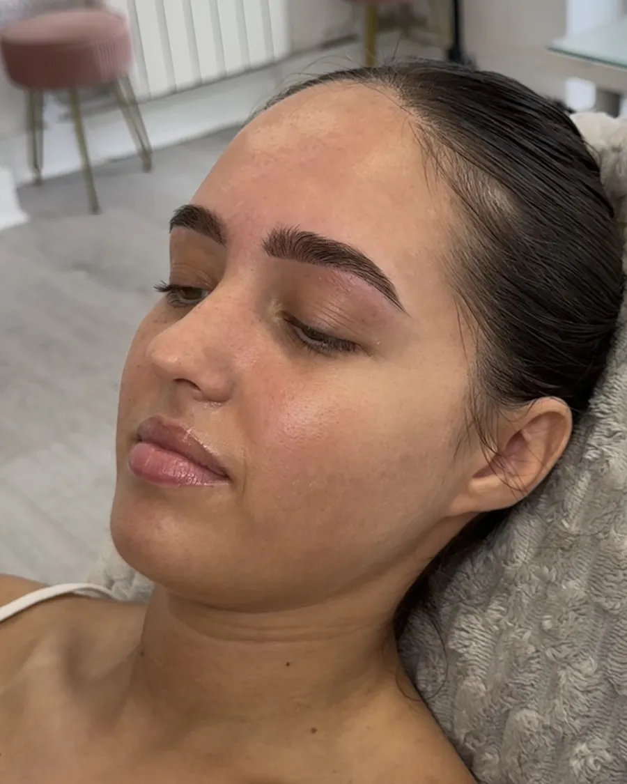 Defined, tinted and tidied brows after treatment